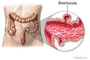 large intestine